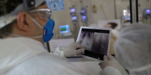 Imagem referente a Covid é principal causa de internação por síndrome respiratória no Rio