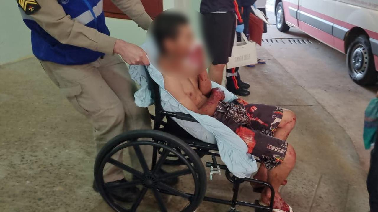 Jovem cai do telhado e com ferimentos é levado ao Hospital Universitário