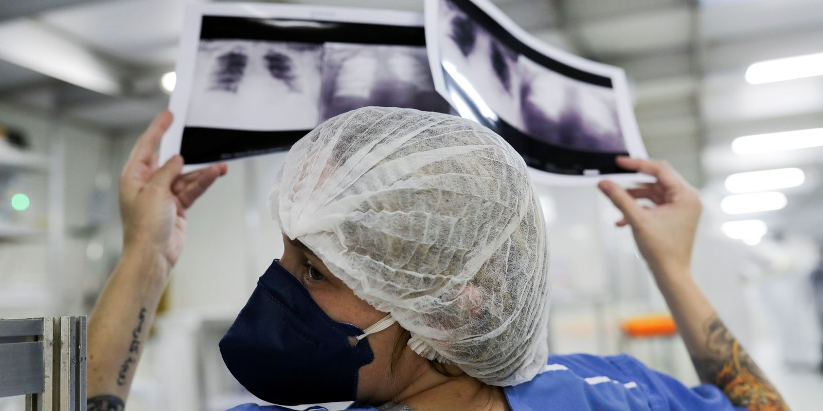 Lei institui campanha para conscientização sobre câncer de pulmão Imagem referente a Lei institui campanha para conscientização sobre câncer de pulmão