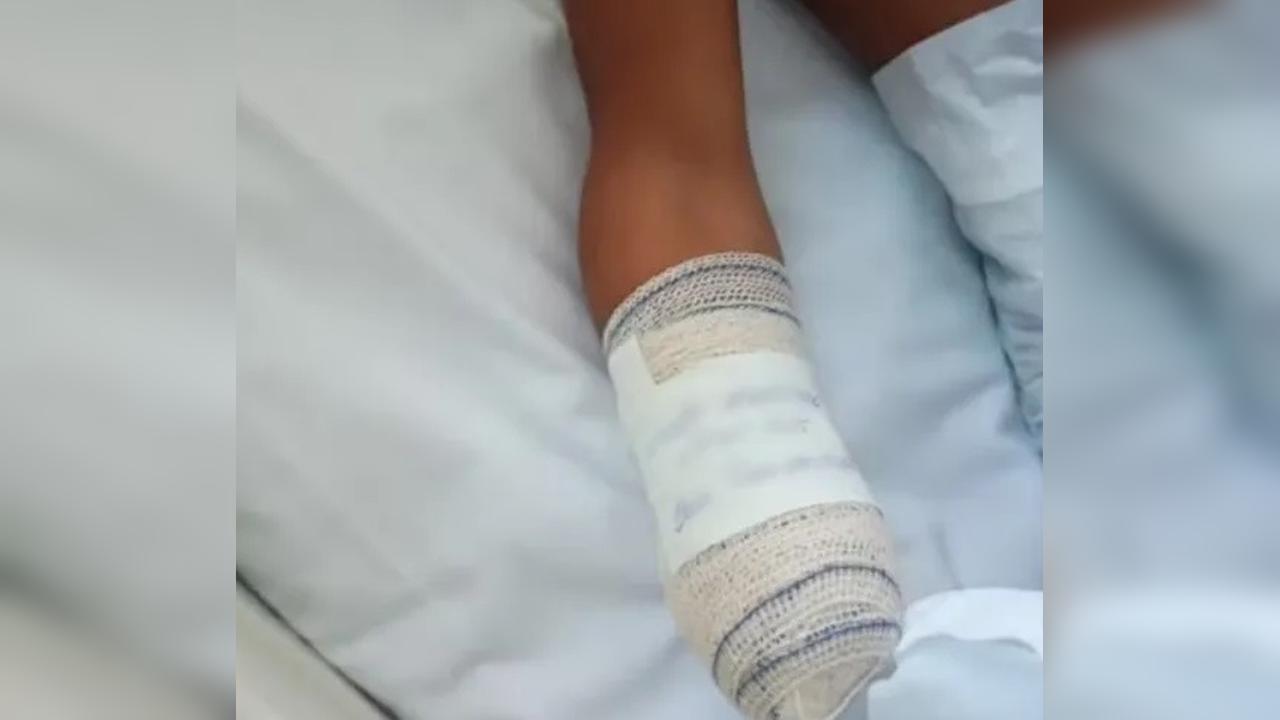Criança perde mão após confundir bomba com peça de bicicleta no RJ