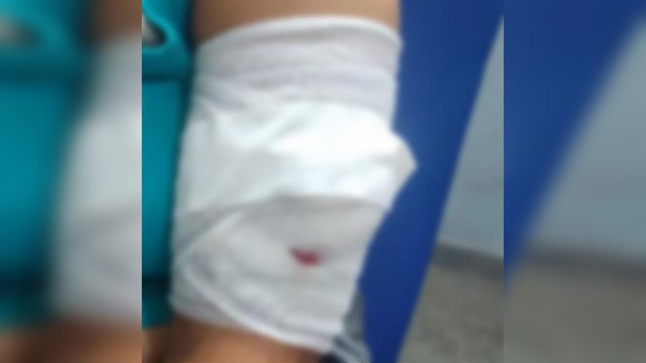Marido diz que levou facada da esposa em briga por ciúmes em Ivaiporã