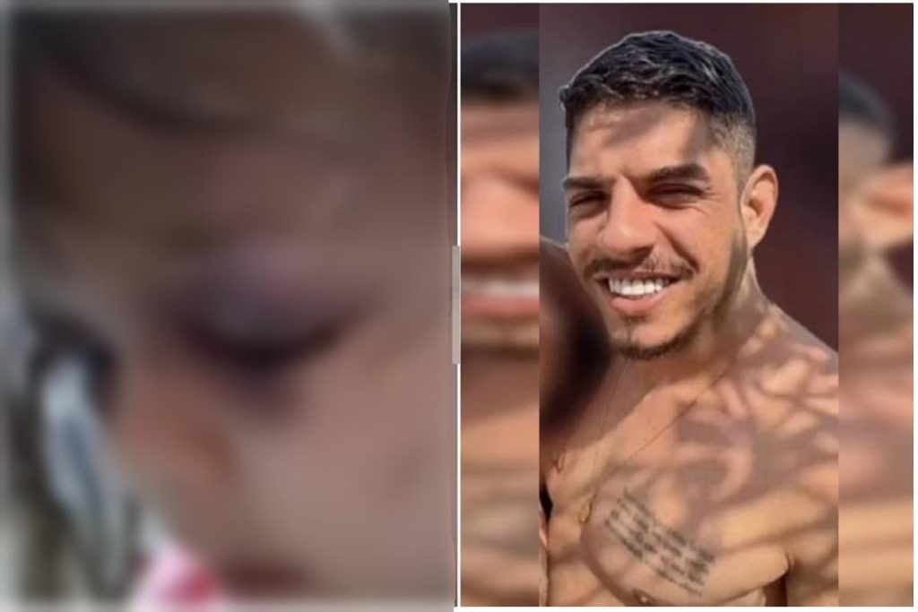 Brutalidade: Criança de três anos é espancada pelo padrasto que está foragido