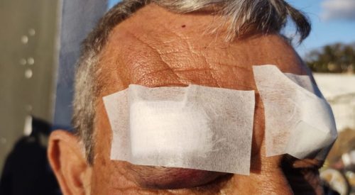 Taxista é atacado com tijolada por passageiro sem dinheiro no Paraná