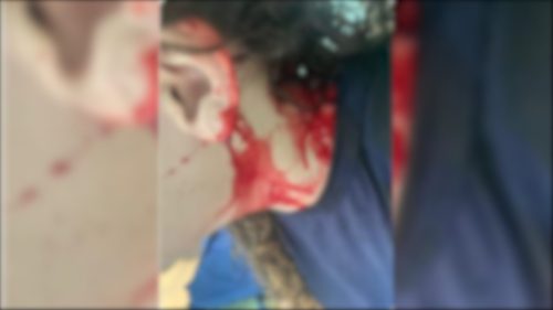 Suposta tentativa de estupro contra menina é registrada no Bairro Barcelona Imagem referente a Suposta tentativa de estupro contra menina é registrada no Bairro Barcelona