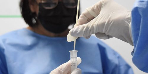 Covid-19 causou metade das mortes por vírus respiratórios em 4 semanas Imagem referente a Covid-19 causou metade das mortes por vírus respiratórios em 4 semanas