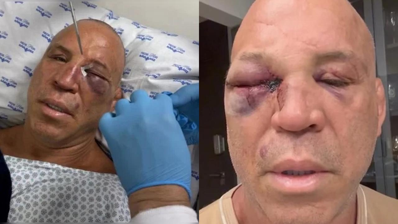 Wanderlei Silva pede anulação da vitória de Popó; CNB nega