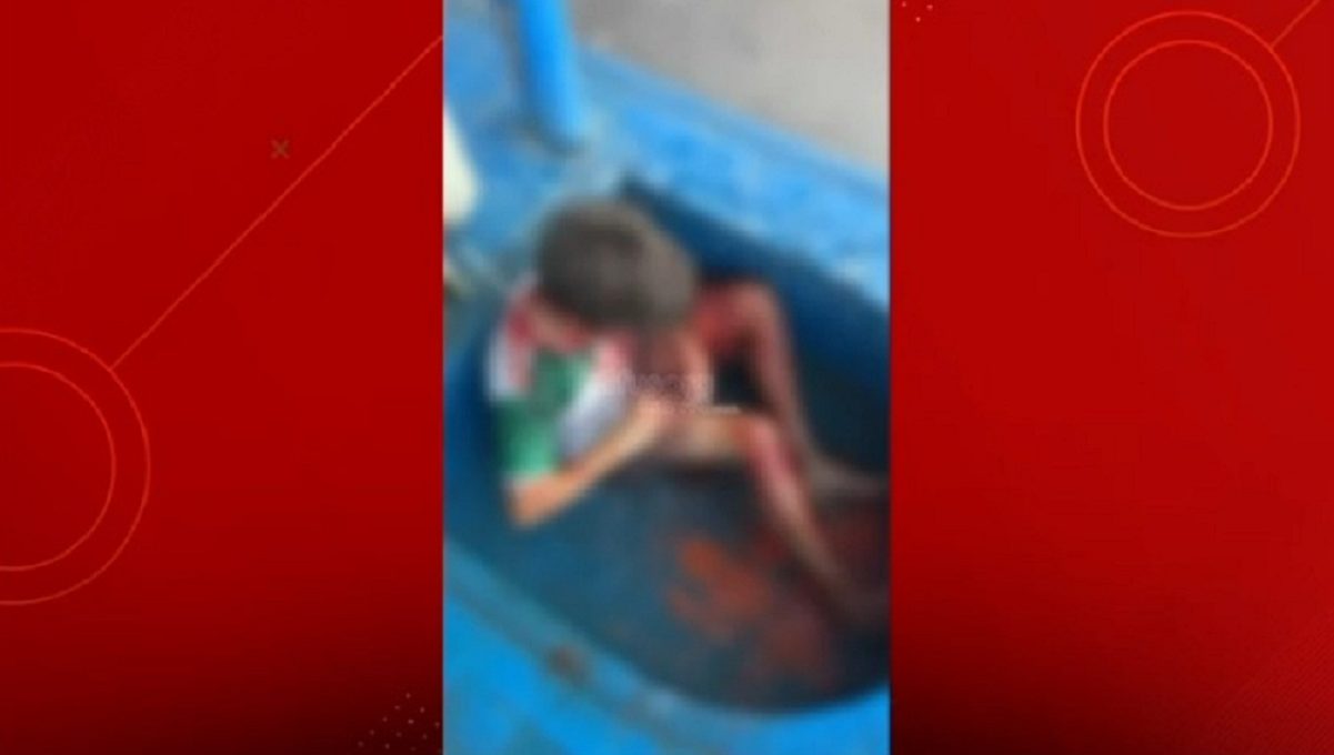 Grave: criança é atacada por porco do mato Grave: criança é atacada por porco do mato