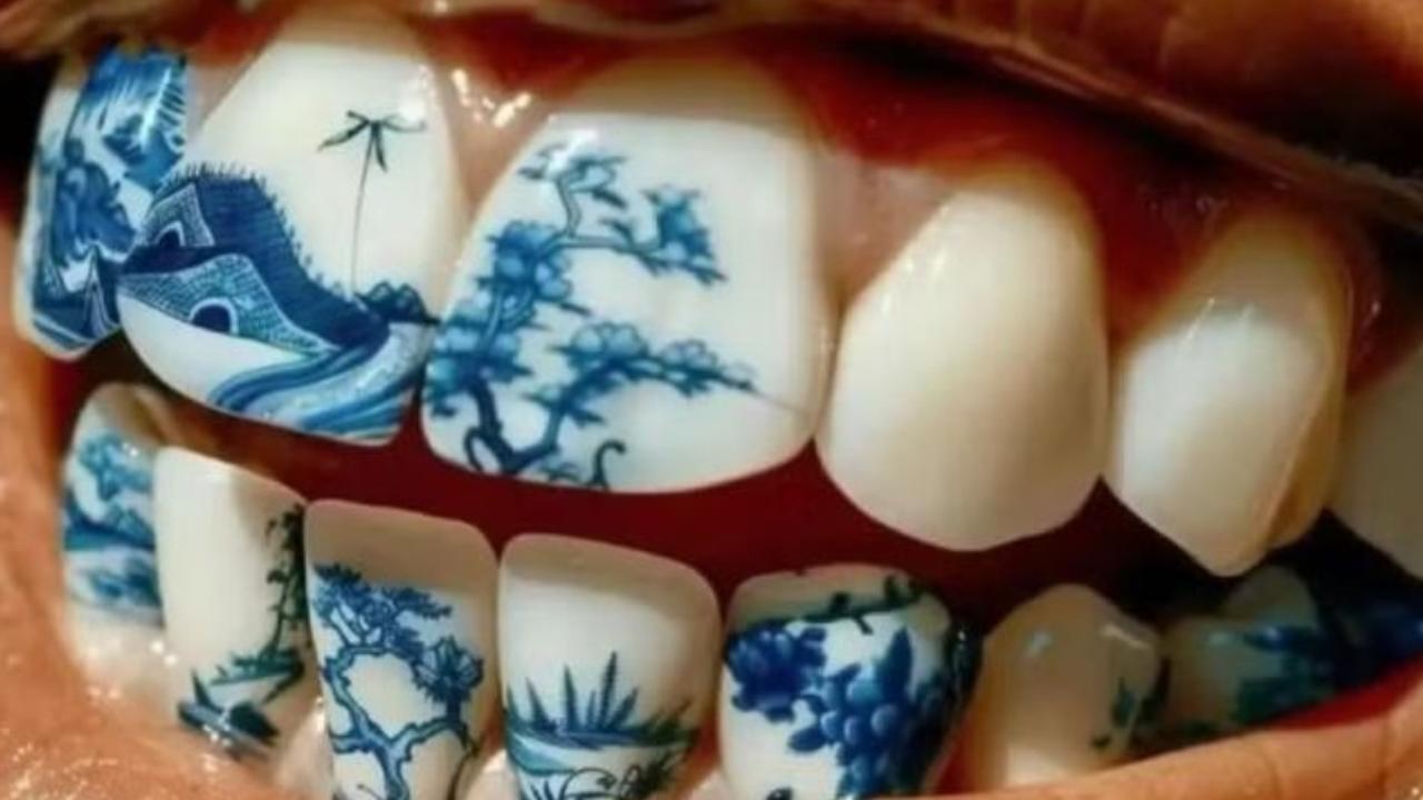 “Tatuagem nos dentes” vira febre entre jovens na China e preocupa especialistas “Tatuagem nos dentes” vira febre entre jovens na China e preocupa especialistas