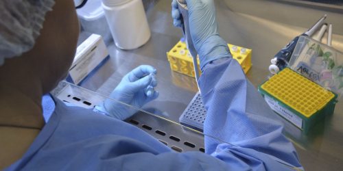 País tem 17 casos confirmados de intoxicação por metanol Imagem referente a País tem 17 casos confirmados de intoxicação por metanol