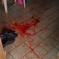 Homem que agrediu violentamente o próprio pai com peça de ferro em Cascavel sofre de esquizofrenia Imagem referente a Homem que agrediu violentamente o próprio pai com peça de ferro em Cascavel sofre de esquizofrenia