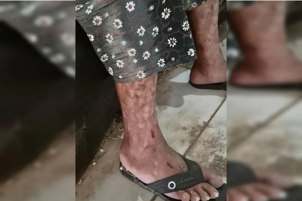 “Morre, velha”: Testemunha ouviu filho que manteve mãe presa gritar