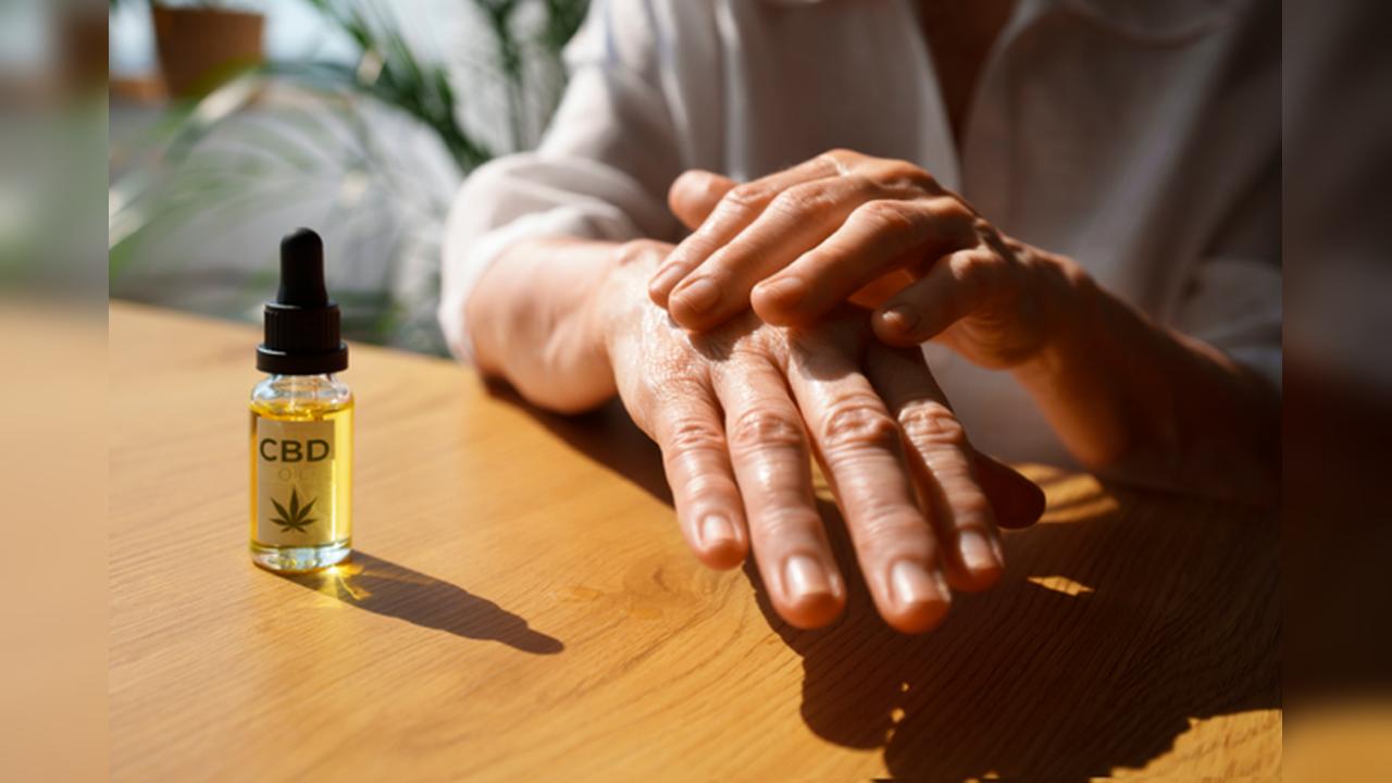 UNILA busca voluntários para testar Cannabis em creme e óleo contra psoríase UNILA busca voluntários para testar Cannabis em creme e óleo contra psoríase