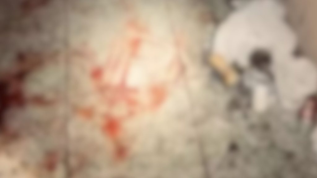 Adolescente é transferido para Cascavel após ser esfaqueado em briga de bar em Boa Vista da Aparecida Adolescente é transferido para Cascavel após ser esfaqueado em briga de bar em Boa Vista da Aparecida