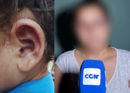 Filha volta da escola com a orelha roxa e mãe denuncia suposta agressão em CMEI de Cascavel