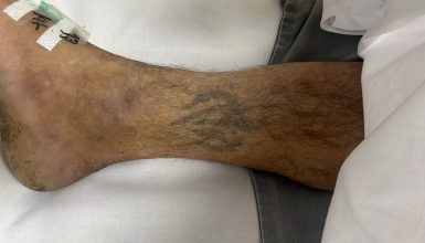 Imagem referente a HUOP pede ajuda da população para identificar paciente internado na UTI