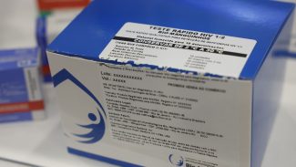 Fiocruz vai ampliar produção de kits diagnósticos para o SUS