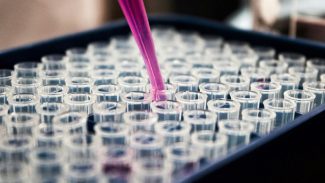 Estudo mostra que inflamação no cérebro pode ser chave do Alzheimer