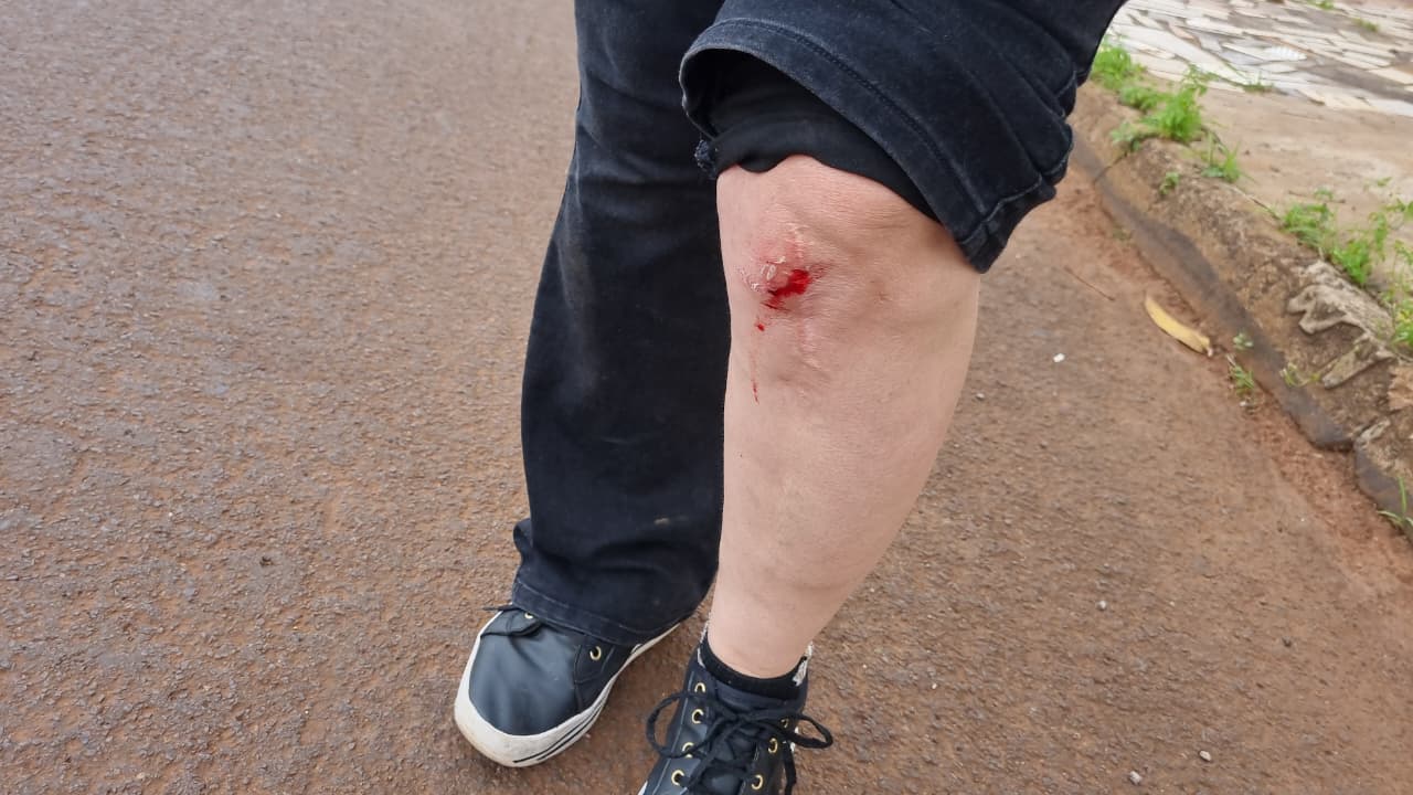 Motociclista tem lesão no joelho após colisão com carro na Avenida Guaíra