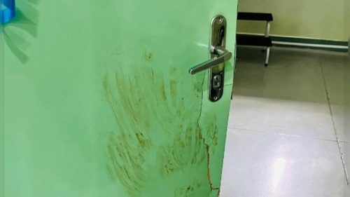 UBS do Jardim São Paulo é alvo de assalto armado em plena tarde