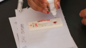 Ação no DF oferece testagem rápida e informação sobre HIV/Aids