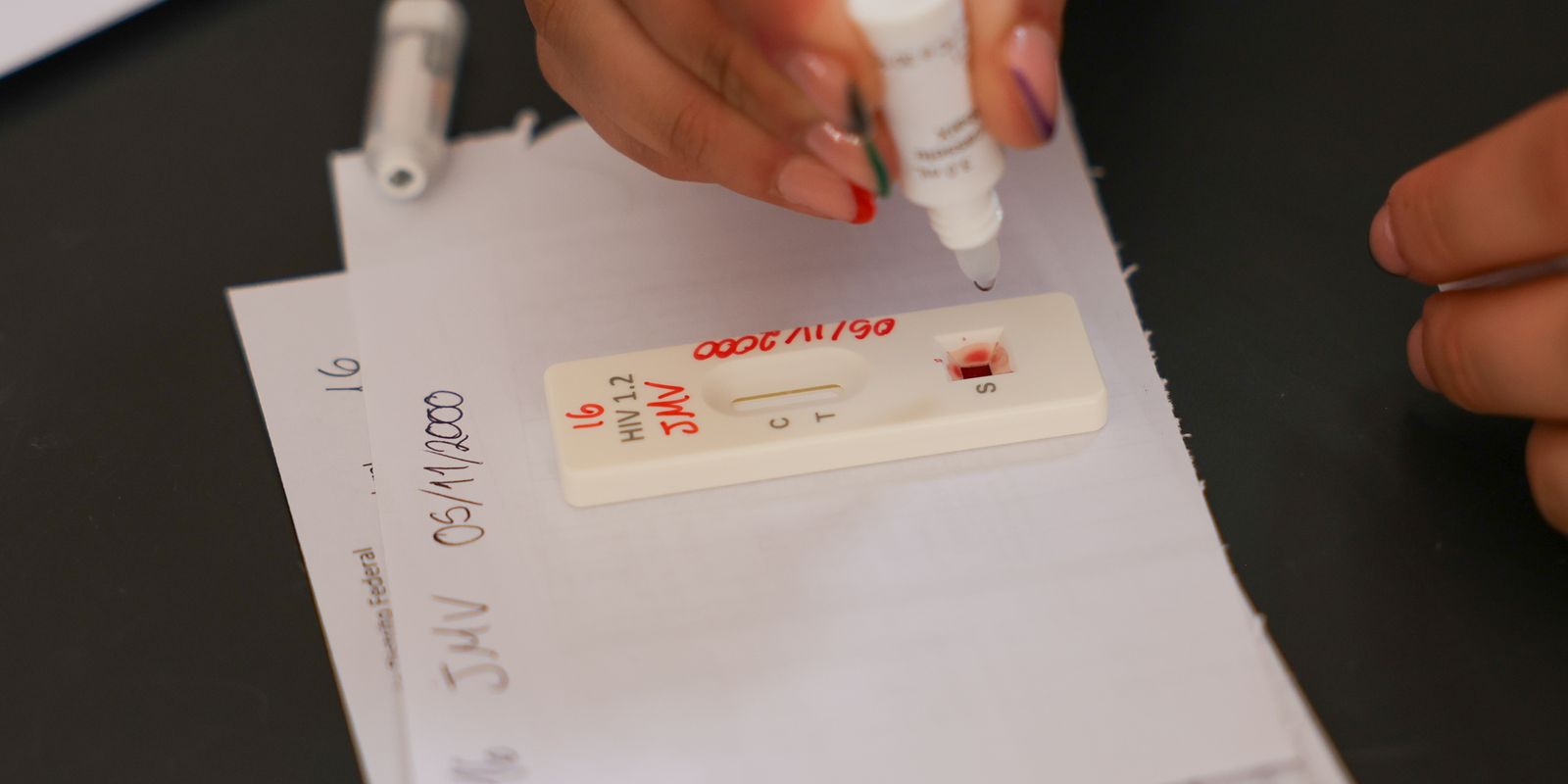Ação no DF oferece testagem rápida e informação sobre HIV/Aids Ação no DF oferece testagem rápida e informação sobre HIV/Aids