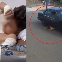 Saiba como está o menino atropelado por condutor bêbado; mãe testemunhou horror Imagem referente a Saiba como está o menino atropelado por condutor bêbado; mãe testemunhou horror