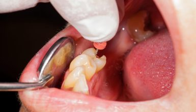 Idosa fica com sequela permanente após cirurgia em Cascavel Imagem referente a Idosa fica com sequela permanente após cirurgia em Cascavel