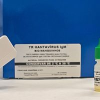 Novo teste faz diagnóstico de hantavirose em 20 minutos Imagem referente a Novo teste faz diagnóstico de hantavirose em 20 minutos