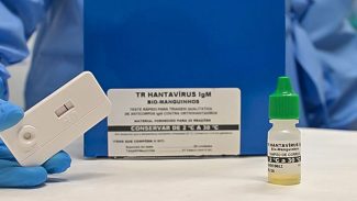Novo teste faz diagnóstico de hantavirose em 20 minutos