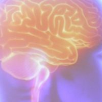 Imagem referente a Projeto Ártemis avalia genética de pacientes que sofreram AVC