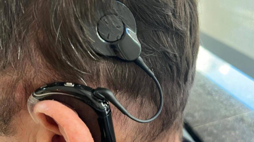 Foi perdido aparelho de surdez no bairro Recanto Tropical