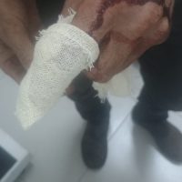 Imagem referente a Irmãos de 66 e 56 anos brigam por terreno, ficam feridos e vão parar na delegacia de Cascavel