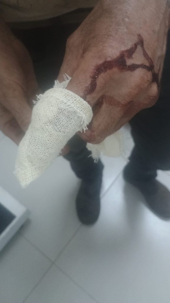 Irmãos de 66 e 56 anos brigam por terreno, ficam feridos e vão parar na delegacia de Cascavel