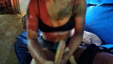 Jovem ferida em ataque dentro de residência conta o que aconteceu Imagem referente a Jovem ferida em ataque dentro de residência conta o que aconteceu