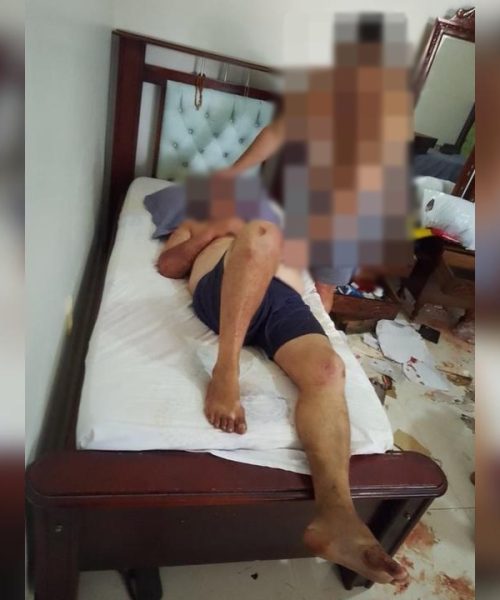 Imagem referente a Amarrado, enforcado e espancado: morador viveu 3h de terror em assalto