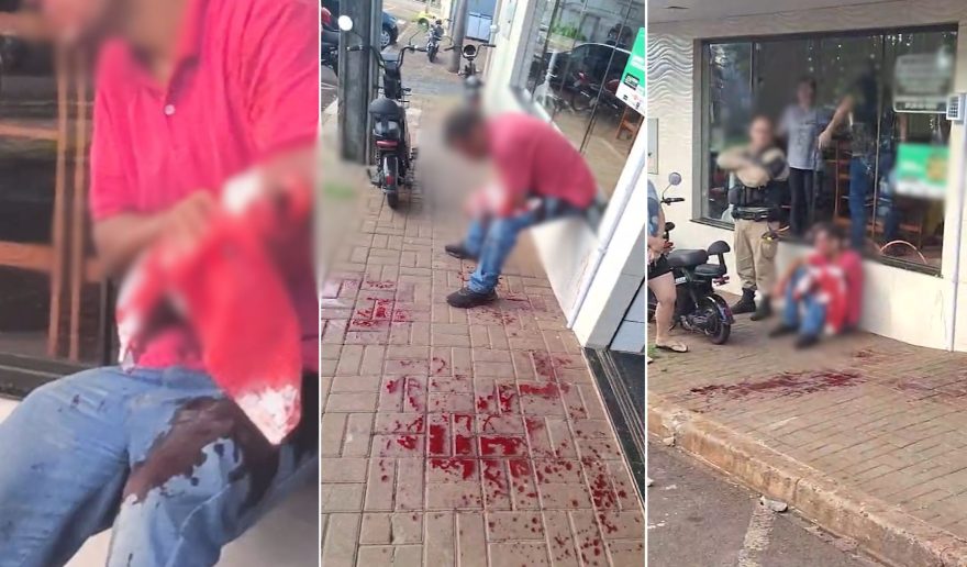 Homem quase tem parte do braço arrancada após levar golpe de facão em Corbélia