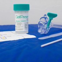 Imagem referente a Guia orienta sobre mudança no rastreamento do câncer de colo do útero