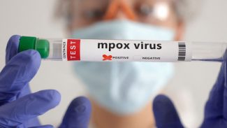 Secretaria de Saúde confirma segundo caso de mpox do grupo lp em SP
