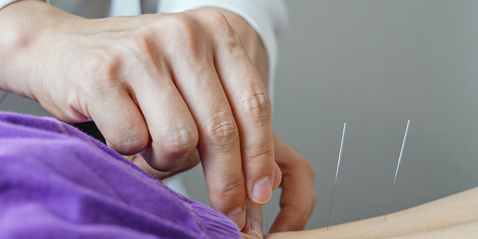 Brasil regulamenta exercício profissional da acupuntura