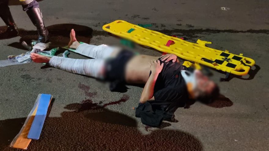Motociclista fica gravemente ferido após colisão frontal na marginal da BR-277