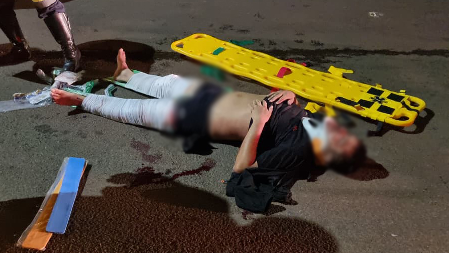 Motociclista fica gravemente ferido após colisão frontal na marginal da BR-277