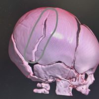 Imagem referente a PCPR investiga lesão corporal grave contra bebê de dois meses em Santa Tereza do Oeste