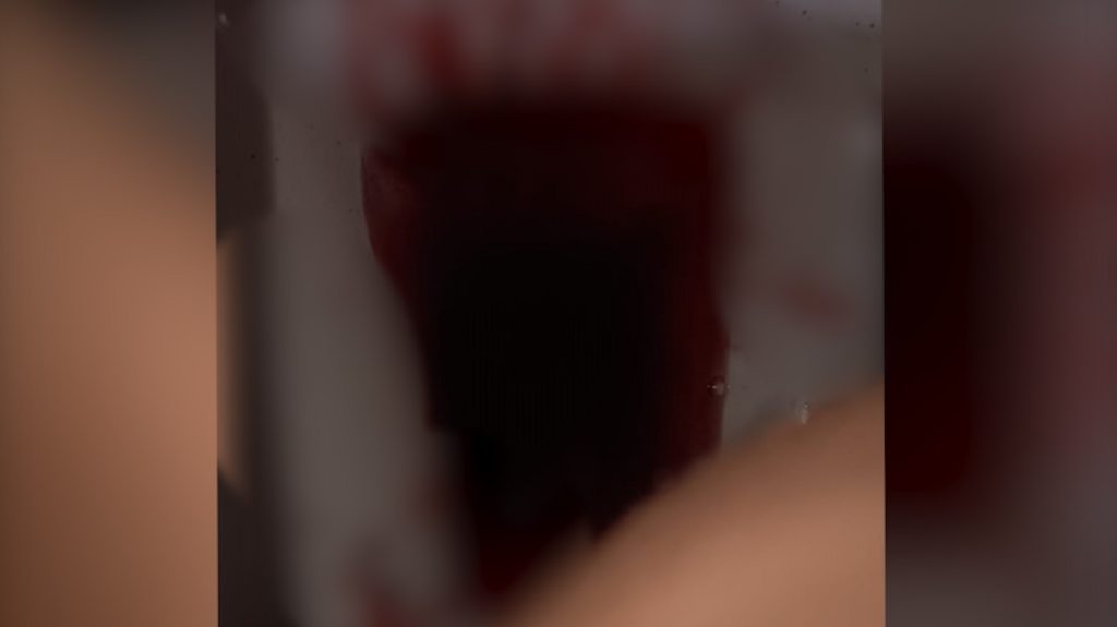 “Só sai sangue”: família de venezuelano implora por socorro médico e reclama de ‘empurra-empurra’
