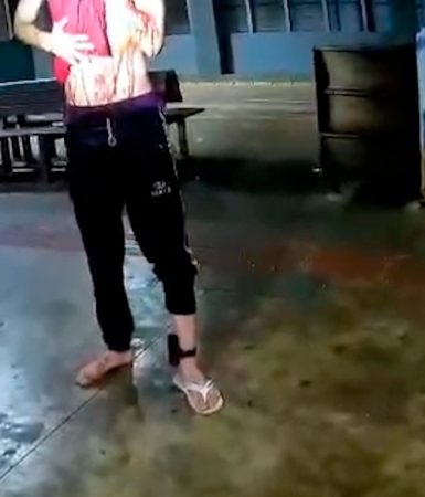 Imagem referente a Assista: Homem esfaqueado no pescoço volta a ser atacado pelo agressor na frente da PM no Terminal Oeste