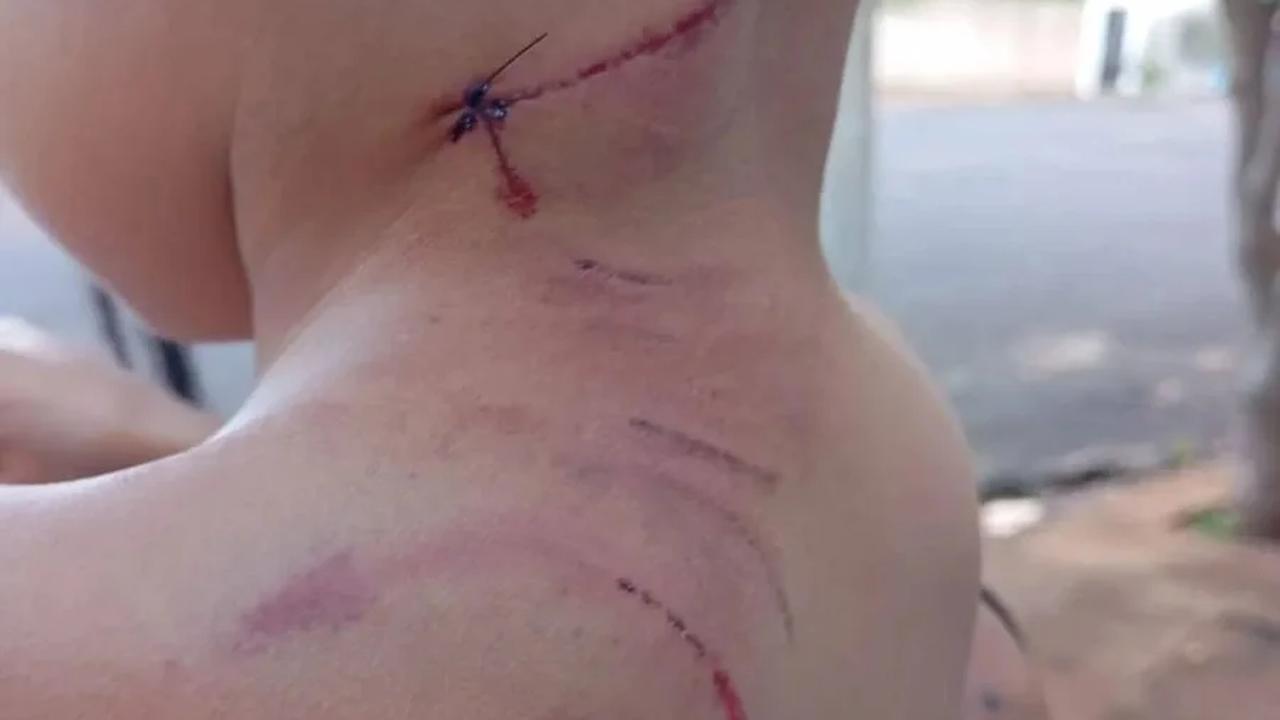 Criança é atacada por cão Labrador que fugiu de casa Criança é atacada por cão Labrador que fugiu de casa