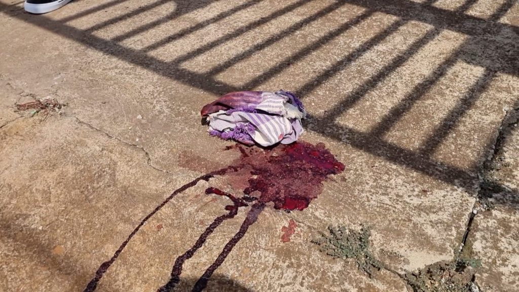 Violência doméstica: mulher leva martelada na cabeça, perde consciência e é levada para o HU