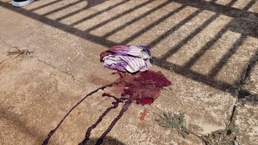 Violência doméstica: mulher leva martelada na cabeça, perde consciência e é levada para o HU