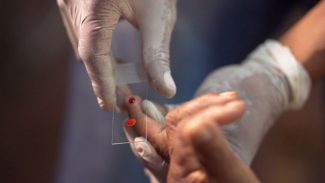 SUS começa a usar novo tratamento contra a malária em crianças