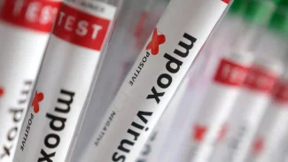 Sobe para 140 número de casos confirmados de Mpox no país, em 2026