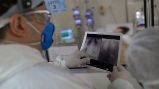 Broncopneumonia: entenda quadro que causou internação de Bolsonaro